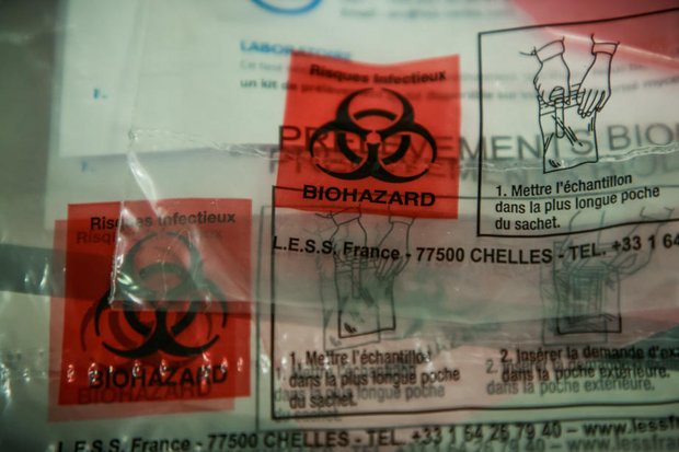 У српским срединама на КиМ епидемиолошка ситуација се погоршава